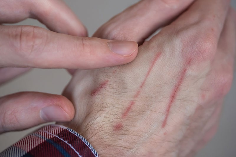 Why Are Cat Scratches Itchy? 4 Vet-Explained Reasons