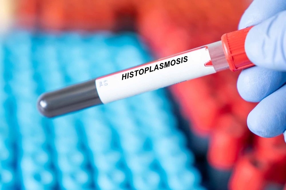 Histoplasmosis in Dogs: Causes, Signs & Treatments (Vet Answer)